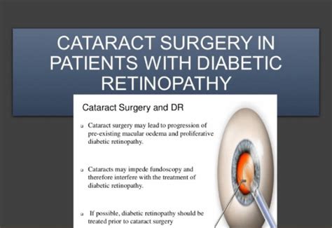post cataract diabetic complications