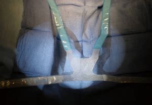 post male sling surgery