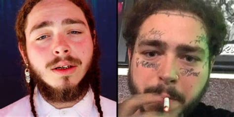 post malone before and after