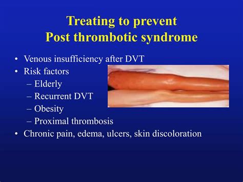 Algorhythm of surgical therapies that can be applied in postthrombotic