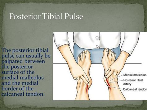 Understanding the Importance of Checking Your Posterior Tibial Pulse for Vascular Health