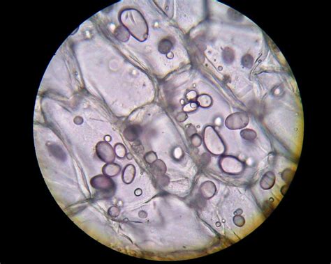 potato cell under microscope labeled
