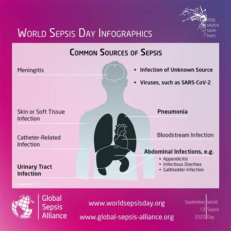 potential causes of sepsis