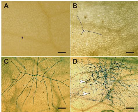 Powdery Mildew Microscopic View