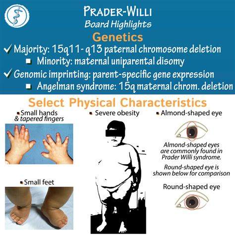 prader willi syndrome wiki