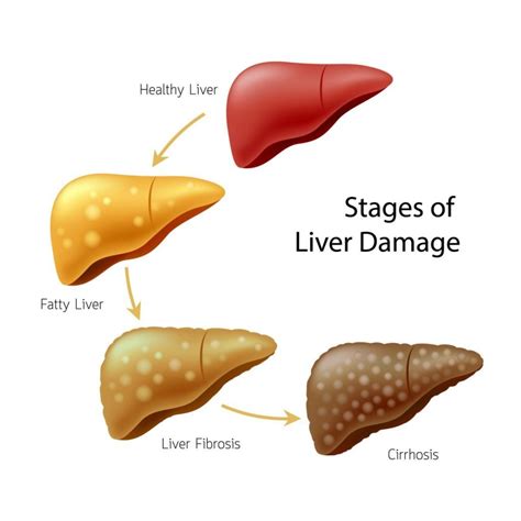 pravastatin and liver damage