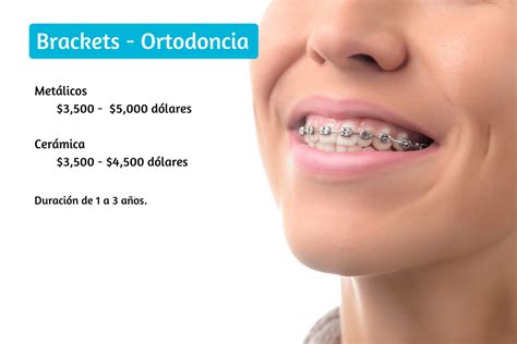 Precio De Brackets En Tijuana