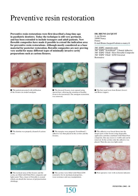 preventive resin restoration code