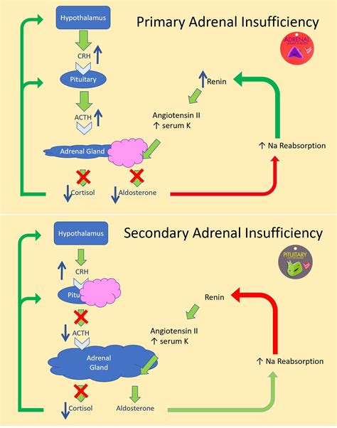 primary adrenal insufficiency vs secondary