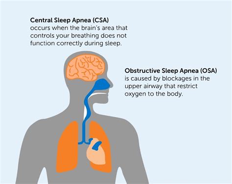 primary central sleep apnea definition