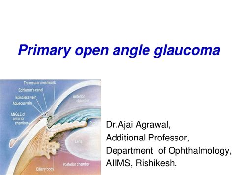 Primary Open Angle Glaucoma Management