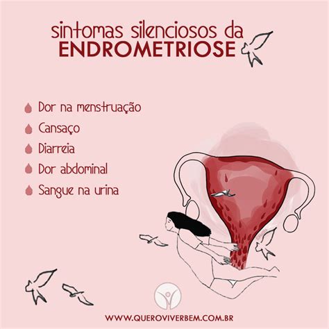 principais sintomas da endometriose