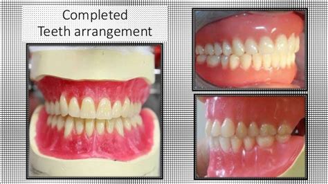 Lets See Principles Of Teeth Arrangement