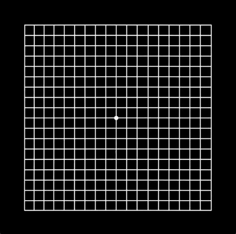 Printable Black Amsler Grid