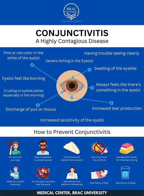 Printable Flyer About Conjunctivits