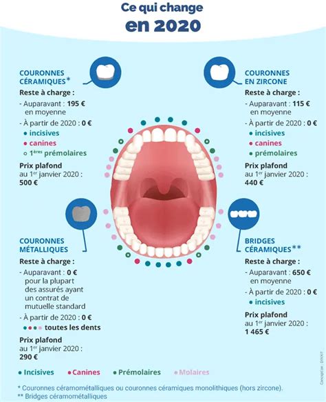 Implant dentaire quels sont ses différents types
