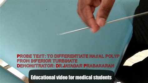 Probe Test Nasal Polyp