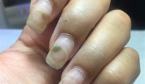 Problems Of Acrylic Nails Why Do Hurt 4 Reasons NailDesignCode