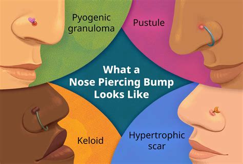 Problems With Nose Piercing
