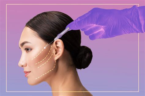 Procedure For Thread Lift