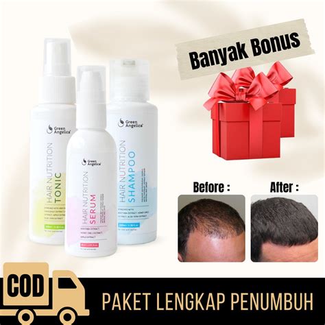 Pelajari Rahasia Produk Penumbuh Rambut Terbaik