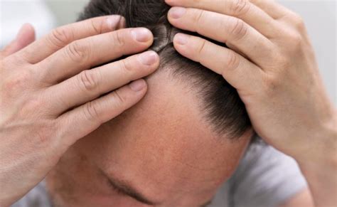 Understanding Progressed Thinning Definition In Relaxed English Language
