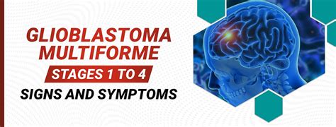 progression of glioblastoma multiforme