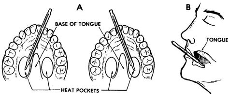 Proper Placement Of Oral Thermometer
