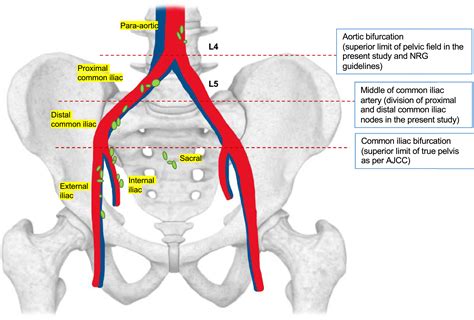 prostate pelvic lymph nodes