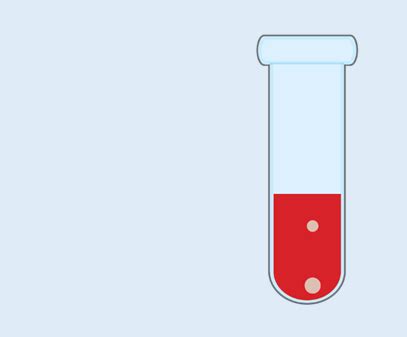 prostate specific antigen labcorp test code