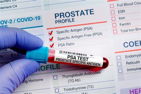 prostate specific antigen test cpt code