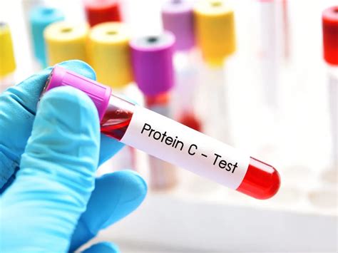 Descubriendo el Poder de la Proteína C Reactiva en Salud