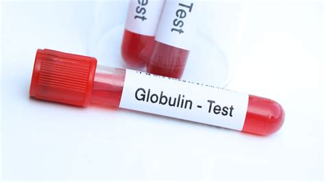 What Does High Protein Globulin Mean for Your Health?