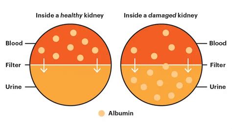 Proteinuria Vca