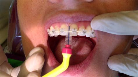 Proxabrush How To Use