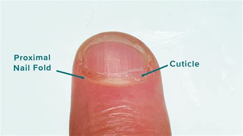 Proximal Nail Fold