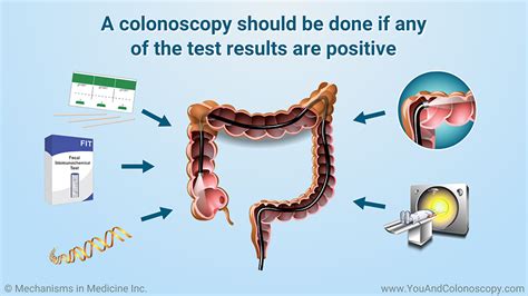 prune pit colonoscopy meaning