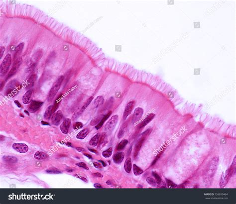 Pseudostratified Columnar Epithelium Function In Trachea