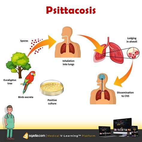 psittacosis symptoms