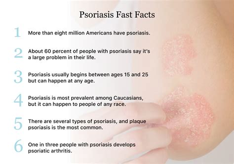 psoriasis diagnosis without flare
