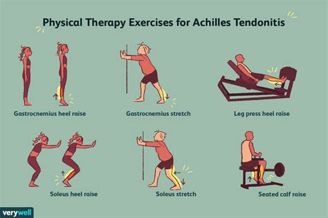 Effective PT for Achilles Tendon Injuries: A Proven Path to Faster Recovery