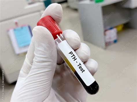 Pth Labcorp Test Tube