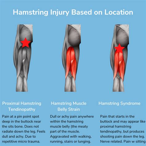 Pulled Hamstring From Walking