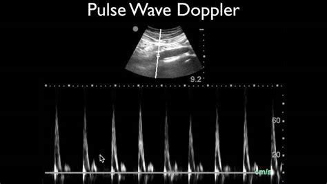 Pulse Doppler Mode