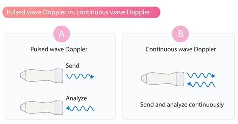 Pulse Wave Doppler Definition