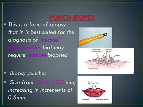 Punch Biopsy Ppt