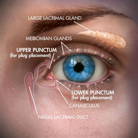 Unlock Eye Health with Punctal Occlusion