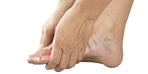 7 Rekomendasi Foot Cream untuk Mengatasi Punggung Kaki yang Gelap dan
