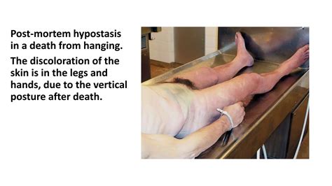 Purge Fluid Post Mortem