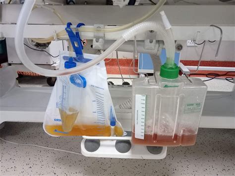 Purpose Of A Chest Drain